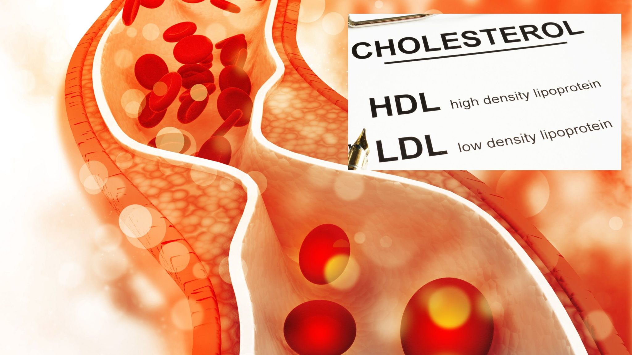 Cholesterin natürlich senken - Quantum-Wave